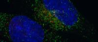 Photo of central nervous system cells expressing the FGFR3-TACC3 fusion protein Photo of cells under microscope